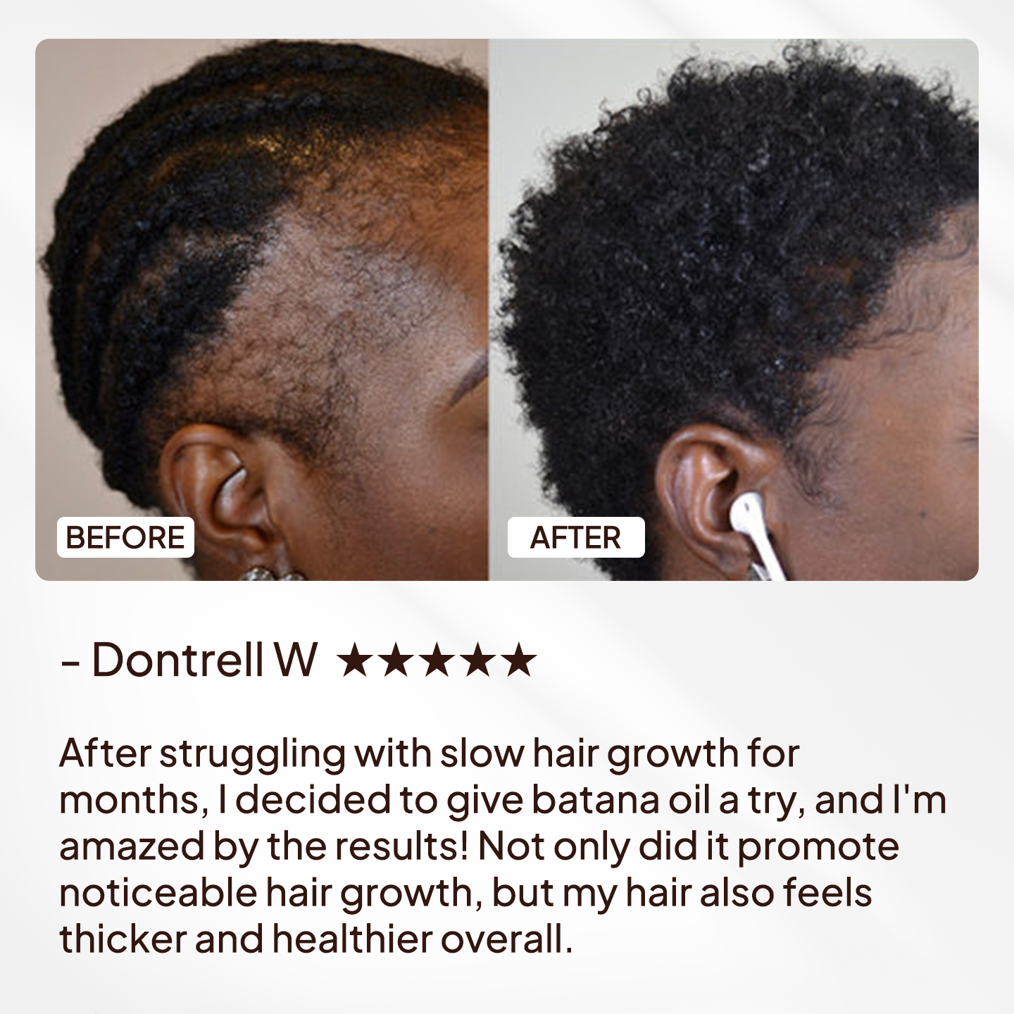 Batana Oil Natural Hair Growth