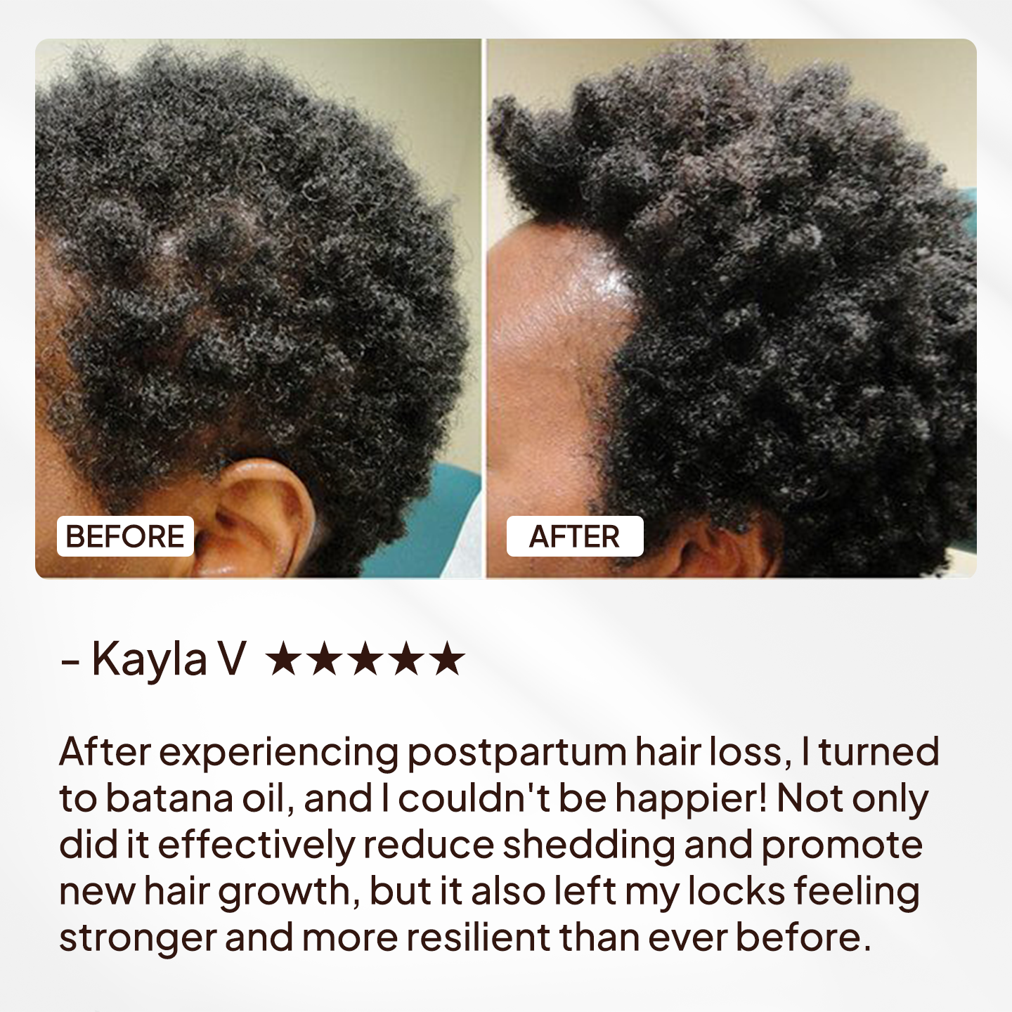 Batana Oil Natural Hair Growth