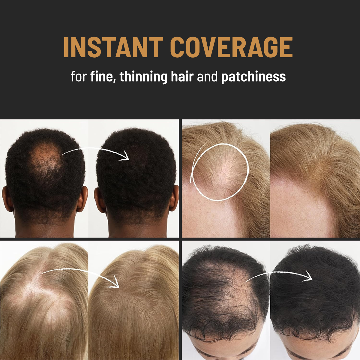 ENHANCIFY - HAIRLINE ENHANCER