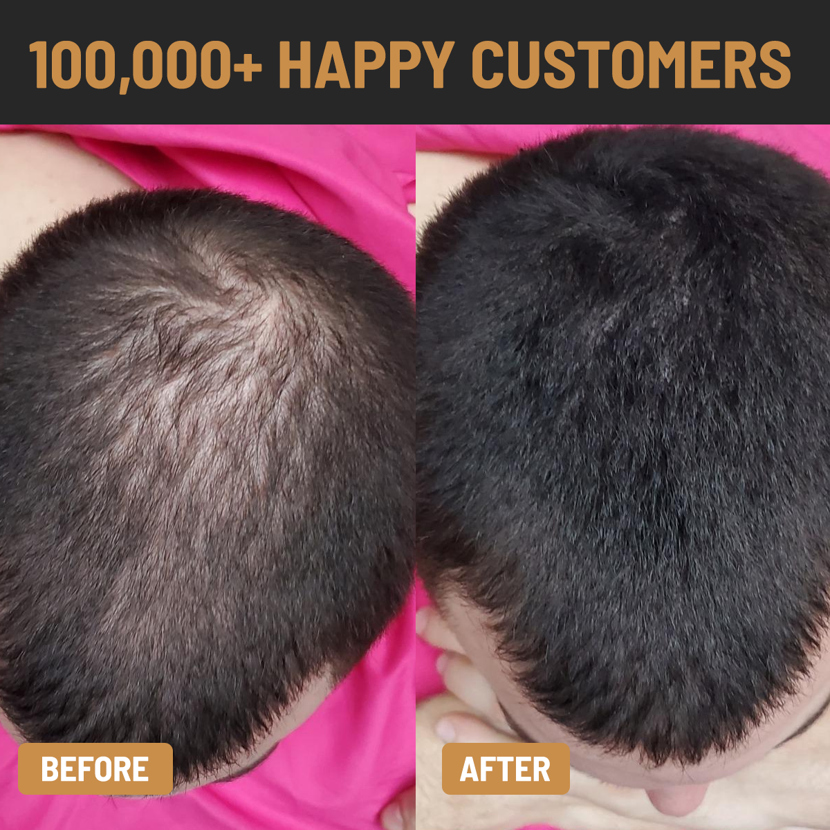 ENHANCIFY - HAIRLINE ENHANCER