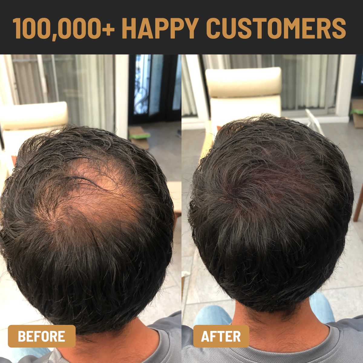 ENHANCIFY - HAIRLINE ENHANCER