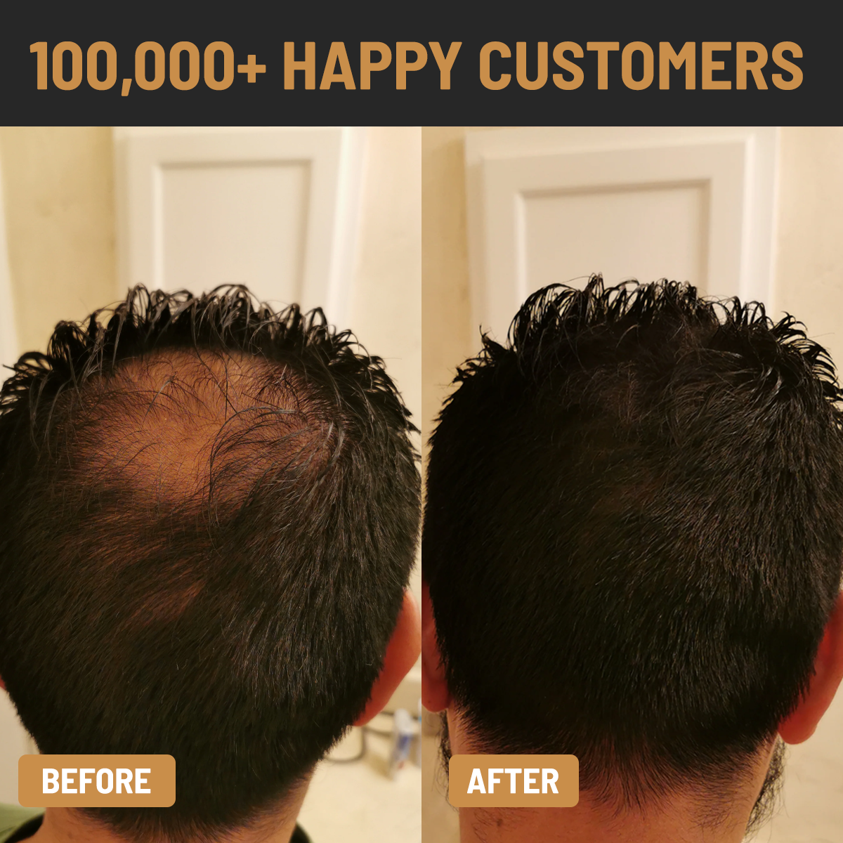 ENHANCIFY - HAIRLINE ENHANCER