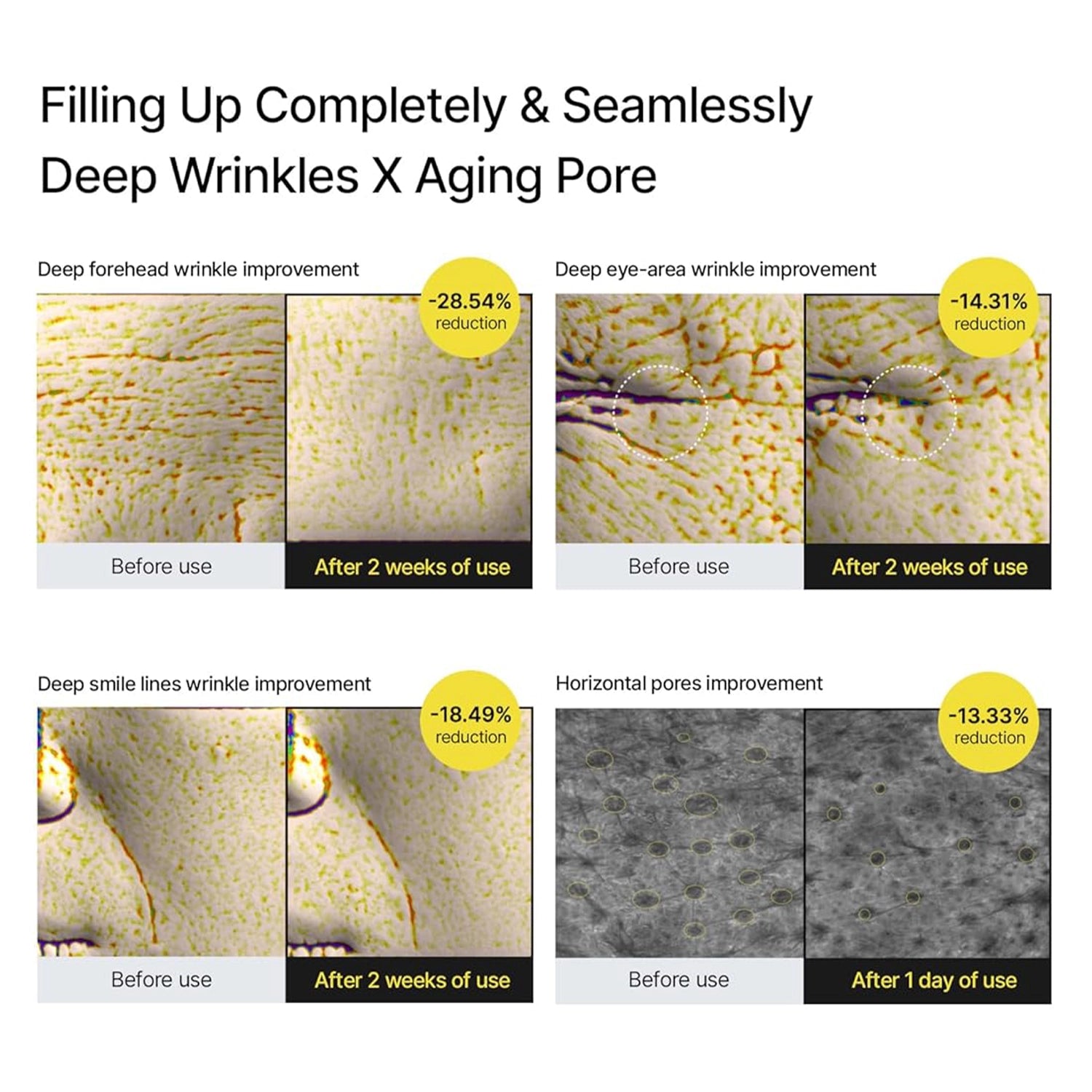 Retinal Tightening Booster