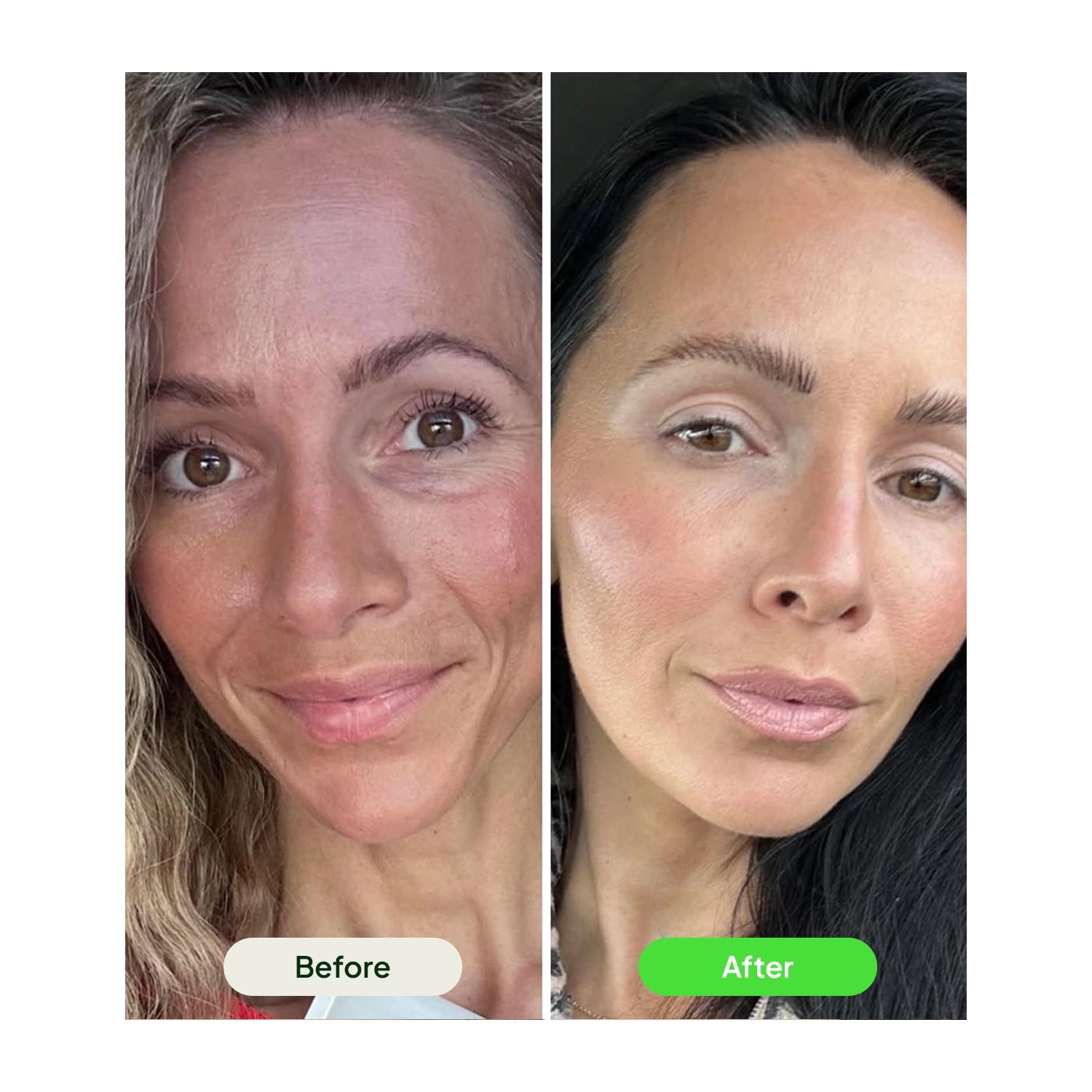 Retinal Tightening Booster