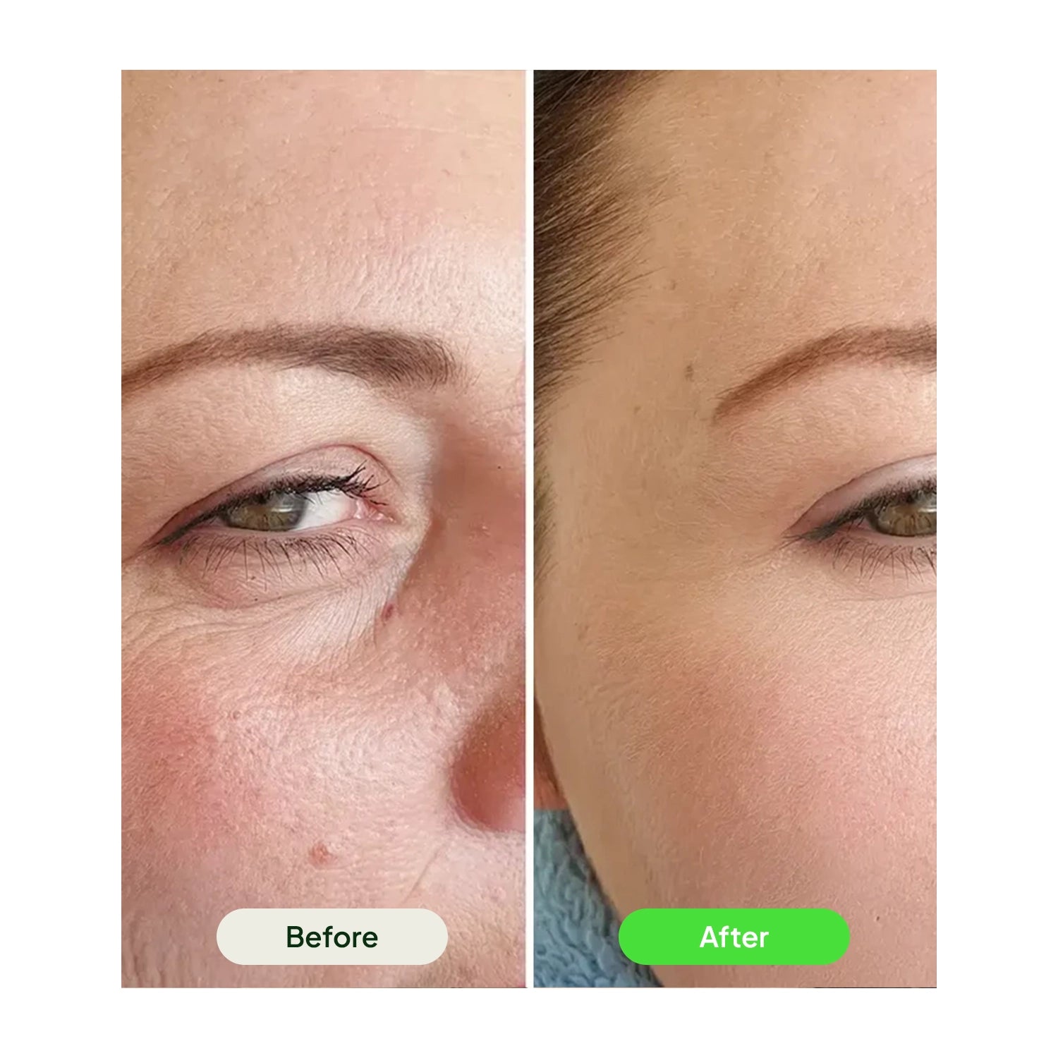 Retinal Tightening Booster