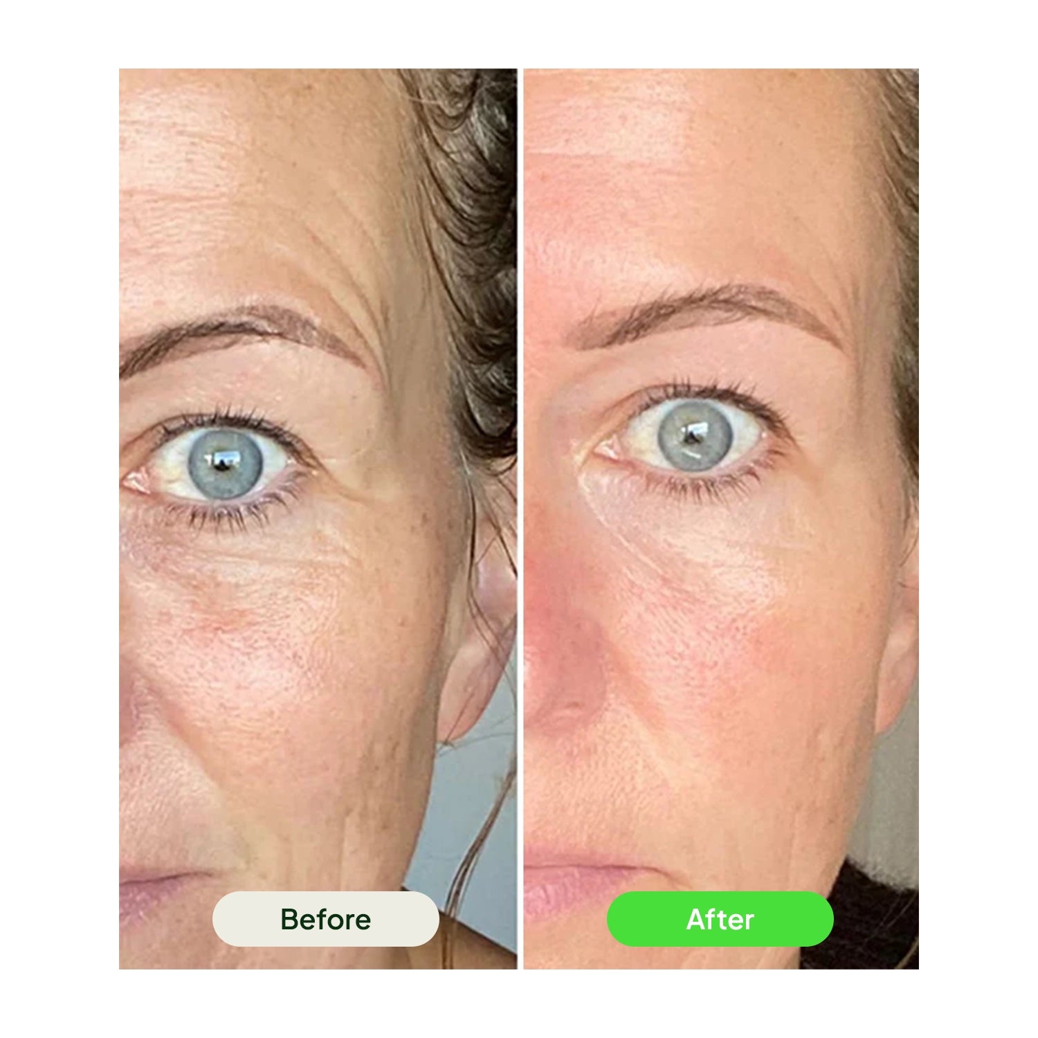 Retinal Tightening Booster